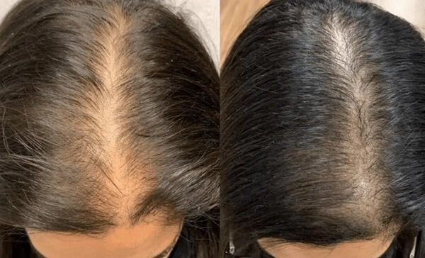 lossless shampon iskustva